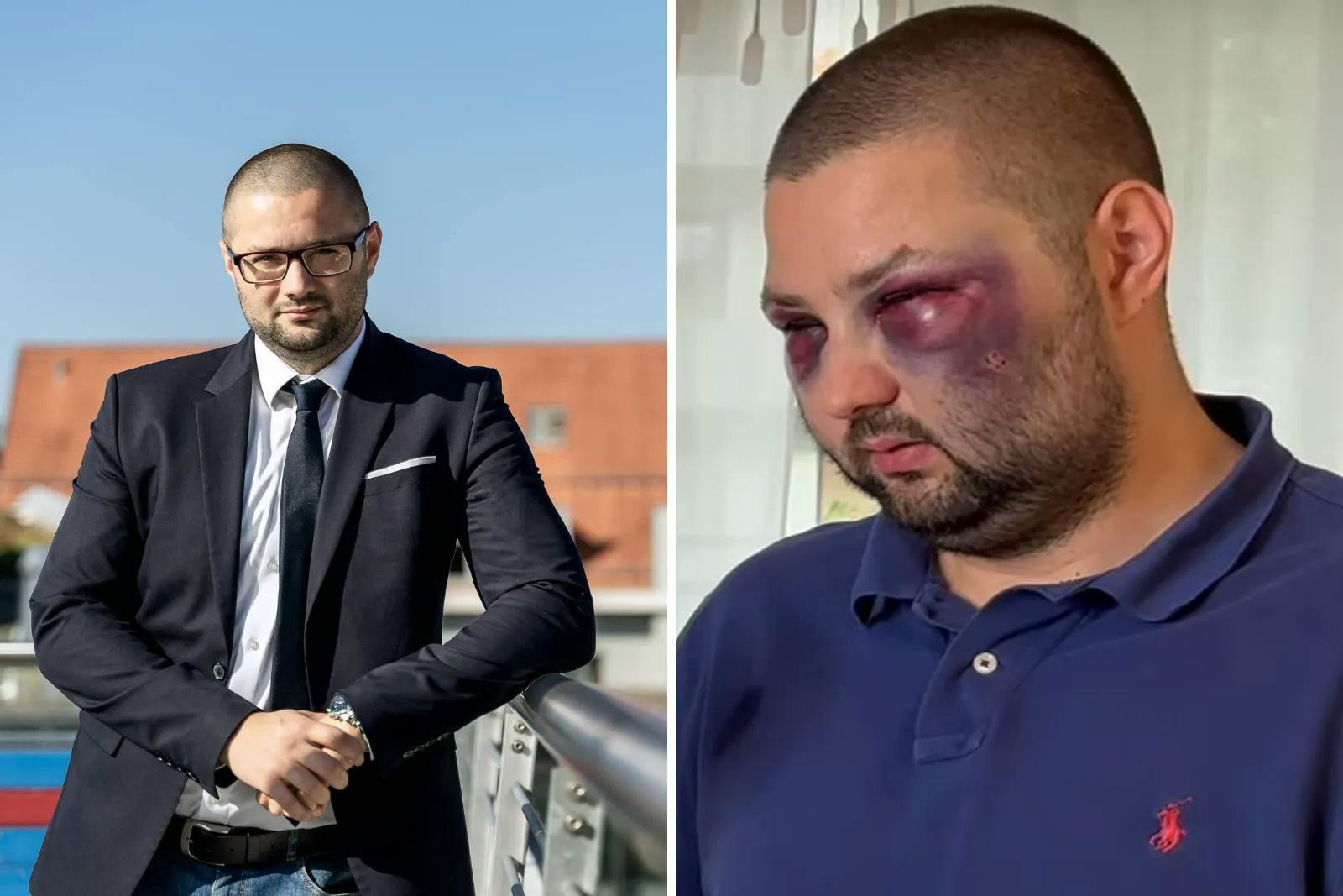 Bayern: AfD-Landtagskandidat Andreas Jurca krankenhausreif geprügelt