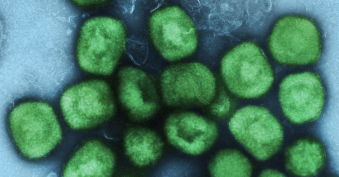 Mpox: Affenpocken bekommen neuen Namen